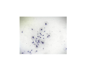 Microscope Slide - Human Spermatozoa, Smear