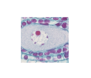 Microscope Slide-Lily Ovulary, Enlarged Megasporophyte c.s.