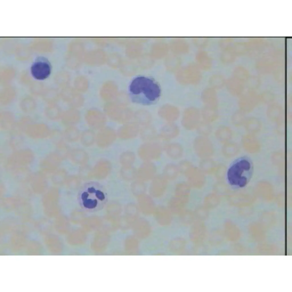 Microscope Slide-Liver, i.s