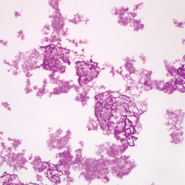 Microscope Slide-Drosophila Chromosomes