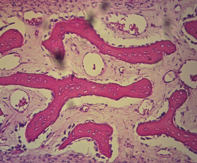 Microscope Slide - Bone, Mammal, Developing Membrane, Sec. 