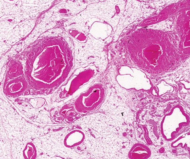 Microscopic Slide - Human Artery and Vein, c.s. 