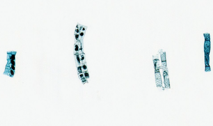 Microscope Slide - Spirogyra Scalariform Conjugation, wm. all 4 stages 