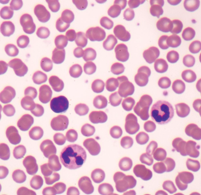 Microscope Slide - Human Blood Film Slide, Smear, Wright's Stain