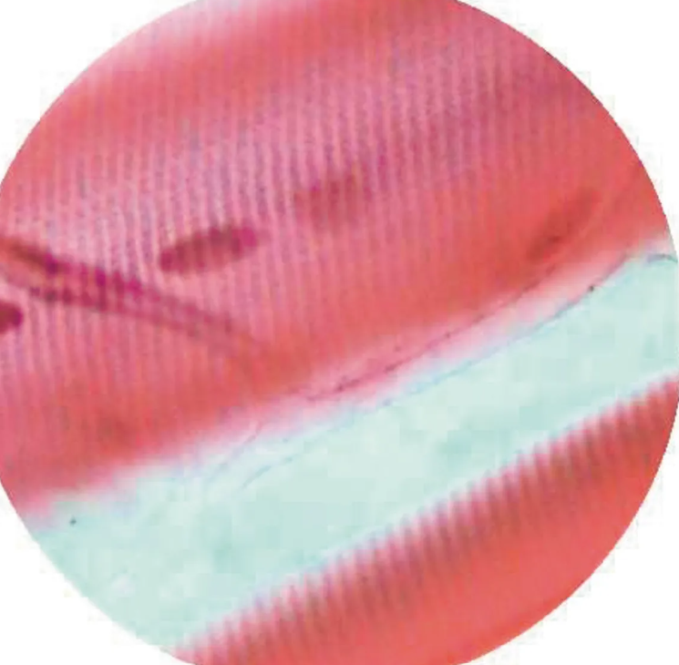 Microscope Slide-Human Cardiac Muscle
