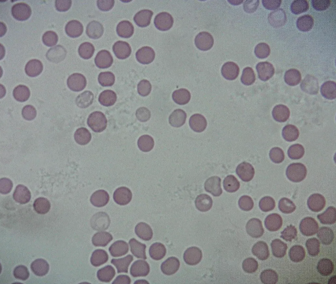 Microscope Slide: Human Blood, giemsa 