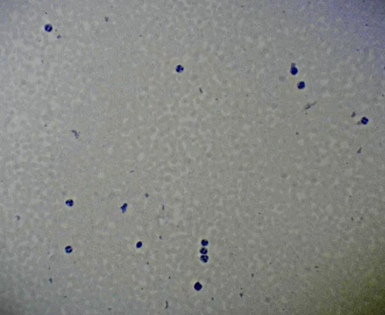 Microscope Slide - Human Blood Smear, stained