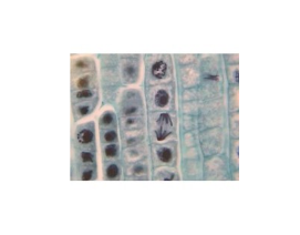 [CAHE1006474] Microscope Slide - Helianthus Young Root, t.s.