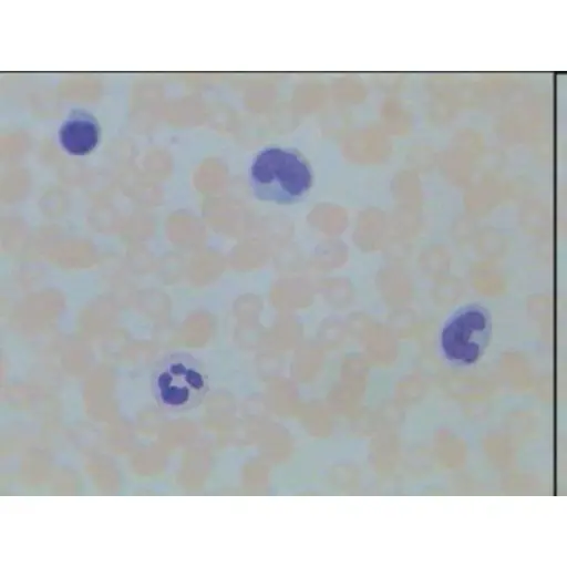 [CAHE1006566] Microscope Slide-Liver, i.s
