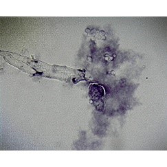 [CAHE1006393] Microscope Slide - Proctoctists - Amoeba Proteus, w.m