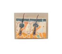 [CAHE1009845] Skin Section Model, mounted on base - 355mm x (W)254mm x (H)50mm