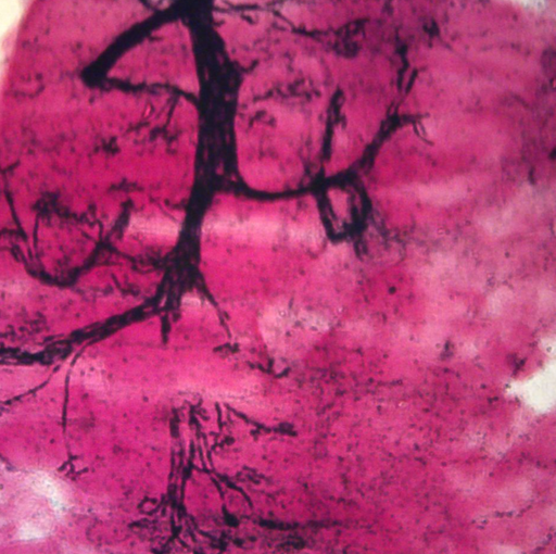 [CA313858] Microscope Slide - Mammal Motor Nerve Ending, Teased 